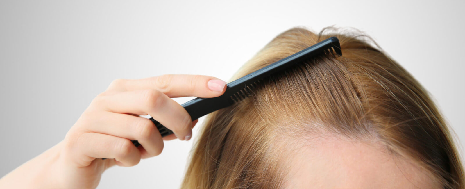 Das Bild zeigt eine Frau, die sich mit einem Kamm durch ihr dünner werdendes Haar fährt. Es illustriert die Problematik des Haarausfalls und verdeutlicht den Bedarf an Behandlungen wie der Haarverpflanzung mit der FUE-Methode. Diese moderne Technik der Haartransplantation entnimmt einzelne Haarfollikel aus einem Spenderbereich und verpflanzt sie in die kahlen oder dünner werdenden Bereiche.