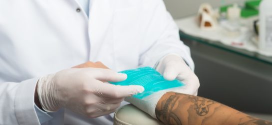 Tattooentfernung mit Picolaser bei Dermacare