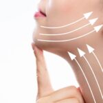 Grafik zum Fadenlifting bei Dermacare in Wien