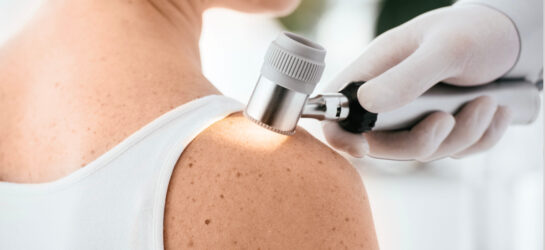 Auf dem Bild ist eine professionelle dermatologische Untersuchung zu sehen. Ein medizinischer Facharzt untersucht mit einem modernen Dermatoskop die Haut am Schulterbereich einer Patientin. Diese Art von Untersuchung wird in dermatologischen Fachzentren wie Dermacare Wien durchgeführt, um Hautveränderungen gründlich zu analysieren und mögliche Ursachen abzuklären. Dazu zählen unter anderem Hautirritationen, Muttermale oder Pilzerkrankungen, die eine präzise Diagnose und gezielte Behandlung erfordern. Das Bild vermittelt eine sorgfältige und vertrauensvolle medizinische Betreuung mit Fokus auf Hautgesundheit.