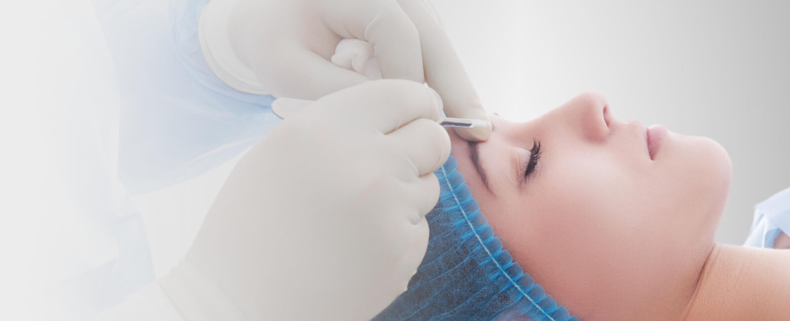 Frau liegt bei Dermacare Wien am Behandlungstisch und bekommt eine operative Oberlidstraffung gegen ihre Schlupflider.